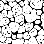 Micrograph of aluminum.